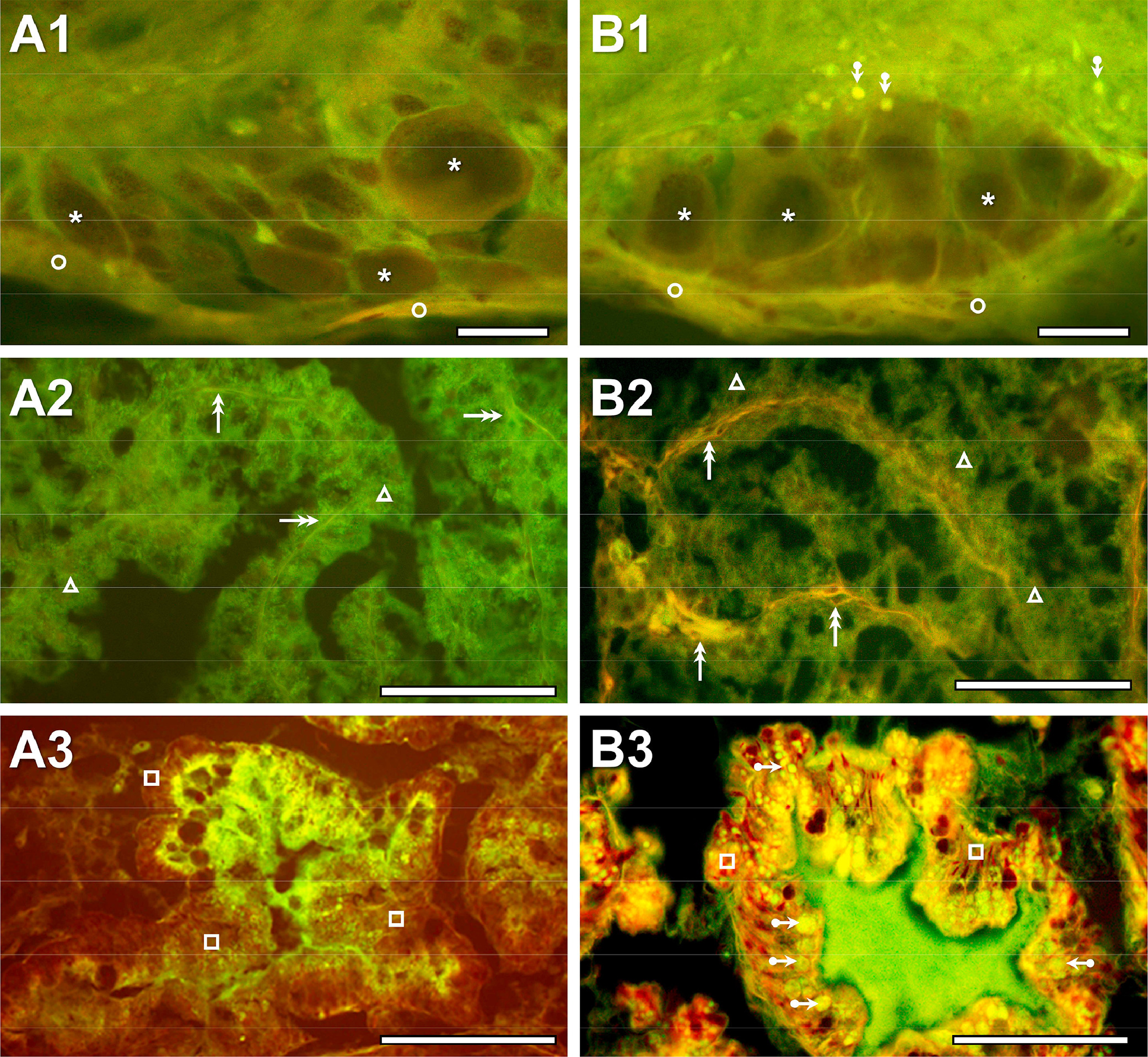 Chronic tributyltin exposure induces metabolic disruption in an invertebrate model animal, Lymnaea stagnalis